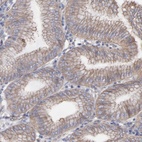 Anti-LRCH2 Antibody