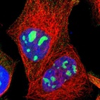 Immunofluorescent staining of human cell line A-431 shows localization to nucleoli.