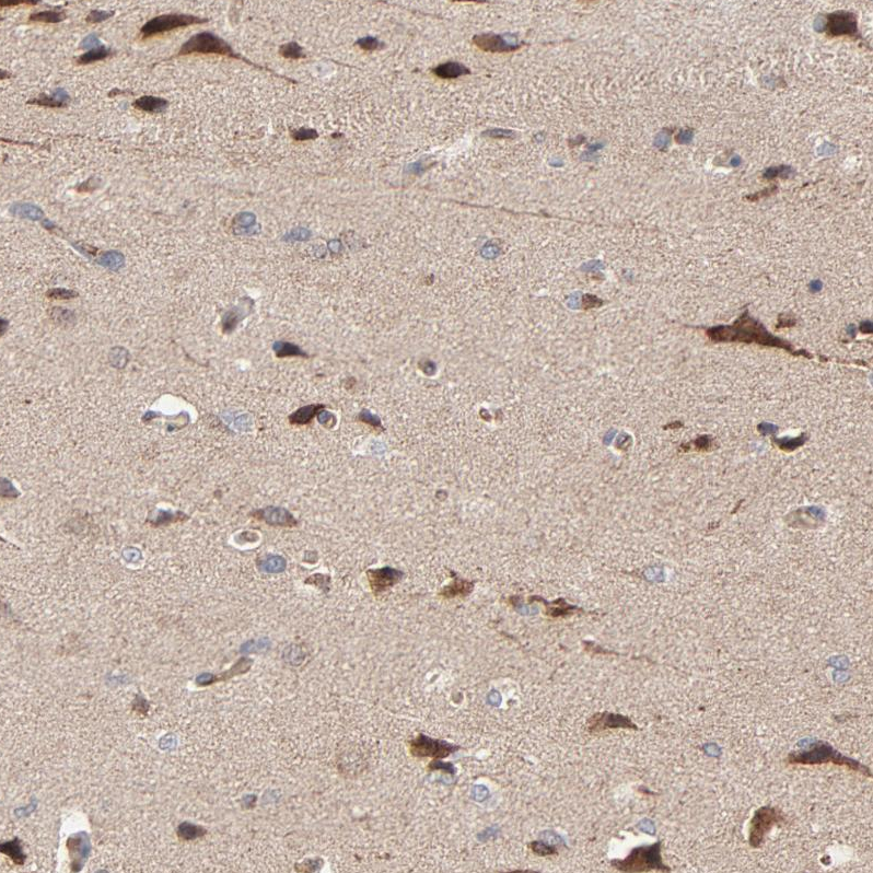 Anti-ABLIM3 Antibody