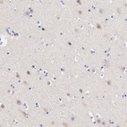 Immunohistochemical staining of human cerebral cortex shows low expression as expected.