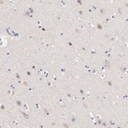 Anti-TNFRSF13C Antibody