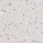 Immunohistochemical staining of human cerebral cortex shows low expression as expected.