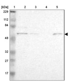 Lane 1: Marker [kDa] 229, 112, 84, 48, 32, 27, 17_br/_Lane 2: Human cell line RT-4_br/_Lane 3: Human cell line U-251MG sp_br/_Lane 4: Human plasma (IgG/HSA depleted)_br/_Lane 5: Human liver tissue