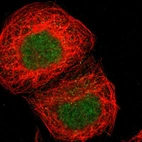 Immunofluorescent staining of human cell line A-431 shows localization to nucleus.