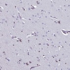 Immunohistochemical staining of human cerebral cortex shows moderate nuclear positivity in oligodendrocytes.