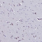 Anti-OLIG2 Antibody