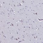 Immunohistochemical staining of human cerebral cortex shows moderate nuclear positivity in oligodendrocytes.