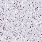 Anti-OLIG2 Antibody