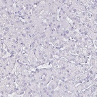 Anti-OLIG2 Antibody