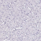 Immunohistochemical staining of human liver shows no positivity as expected.