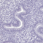 Immunohistochemical staining of human endometrium shows no positivity in glandular cells as expected.