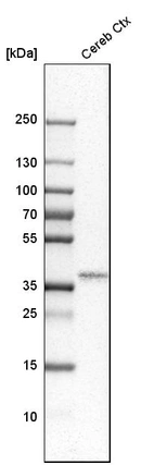 Western blot analysis in human cerebral cortex tissue.
