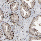 Immunohistochemical staining of human prostate shows strong nuclear positivity in glandular and smooth muscle cells.