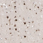 Immunohistochemical staining of human cerebral cortex shows strong nuclear positivity in neurons.