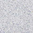 Immunohistochemical staining of human liver shows low positivity in hepatocytes as expected.