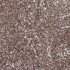 Anti-GABPA Antibody