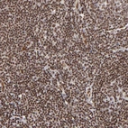 Immunohistochemical staining of human tonsil shows strong nuclear positivity in non-germinal center cells.