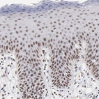 Immunohistochemical staining of human skin shows strong nuclear positivity in squamous epithelial cells.