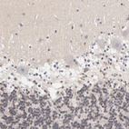 Immunohistochemical staining of human cerebellum shows no positivity in Purkinje cells as expected.