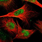 Immunofluorescent staining of human cell line U-251 MG shows localization to nucleoplasm.