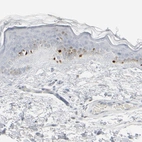 Immunohistochemical staining of human skin shows moderate to strong nuclear positivity in melanocytes.