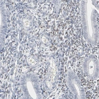 Immunohistochemical staining of human endometrium shows moderate nuclear positivity in cells in endometrial stroma.
