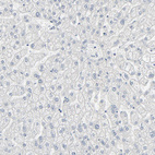 Immunohistochemical staining of human liver shows no positivity in hepatocytes as expected.