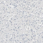 Immunohistochemical staining of human liver shows no positivity in hepatocytes as expected.