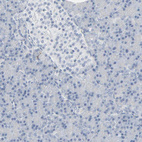 Anti-MITF Antibody