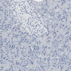 Immunohistochemical staining of human pancreas shows no positivity in exocrine glandular cells as expected.