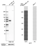 Western blot analysis in human cell lines SK-MEL-30 and MCF-7 using Anti-MITF antibody. Corresponding MITF RNA-seq data are presented for the same cell lines. Loading control: Anti-PFN1.