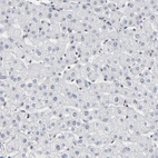 Immunohistochemical staining of human liver shows no positivity in hepatocytes as expected.