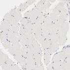 Immunohistochemical staining of human skeletal muscle shows no positivity in myocytes.