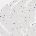 Immunohistochemical staining of human skeletal muscle shows no positivity in myocytes.