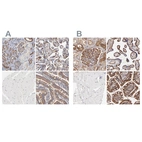 Immunohistochemical staining of human kidney, placenta, skeletal muscle and small intestine using Anti-CD2AP antibody HPA003267 (A) shows similar protein distribution across tissues to independent antibody HPA003326 (B).