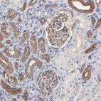 Immunohistochemical staining of human kidney shows moderate membranous positivity in cells in glomeruli.