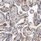 Immunohistochemical staining of human placenta shows strong cytoplasmic positivity in endothelial cells.