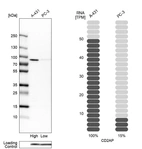 Western blot analysis in human cell lines A-431 and PC-3 using Anti-CD2AP antibody. Corresponding CD2AP RNA-seq data are presented for the same cell lines. Loading control: Anti-PFN1.