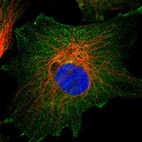 Immunofluorescent staining of human cell line U-251 MG shows localization to plasma membrane & cytosol.