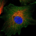 Immunofluorescent staining of human cell line U-251 MG shows localization to plasma membrane & cytosol.