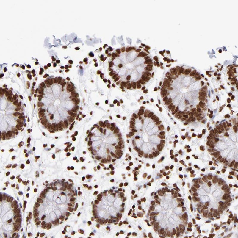 Anti-ZCCHC16 Antibody