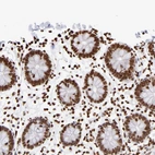 Anti-ZCCHC16 Antibody