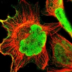 Immunofluorescent staining of human cell line A-431 shows localization to nucleoplasm, plasma membrane & cytosol.