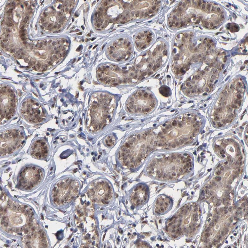 Anti-ZNF419 Antibody