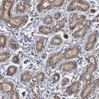 Anti-ZNF419 Antibody