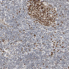 Immunohistochemical staining of human tonsils shows strong nuclear positivity in germinal center cells.