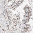 Immunohistochemical staining of human prostate shows weak to moderate nuclear positivity in glandular cells and smooth muscle cells.
