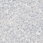 Anti-CUX1 Antibody