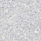 Immunohistochemical staining of human liver shows no positivity in hepatocytes as expected.