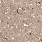 Anti-OPTN Antibody